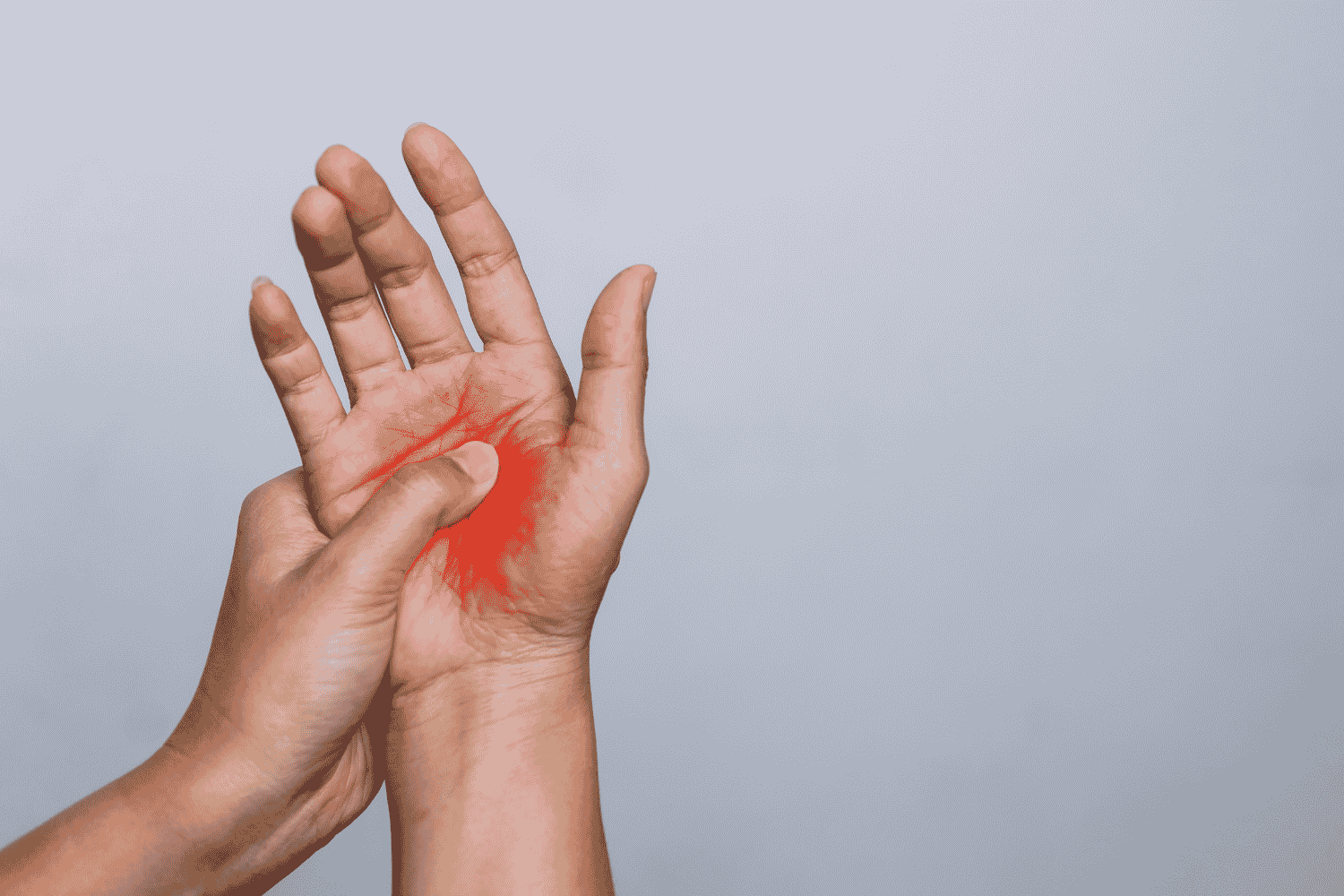 carpal tunnel syndrome